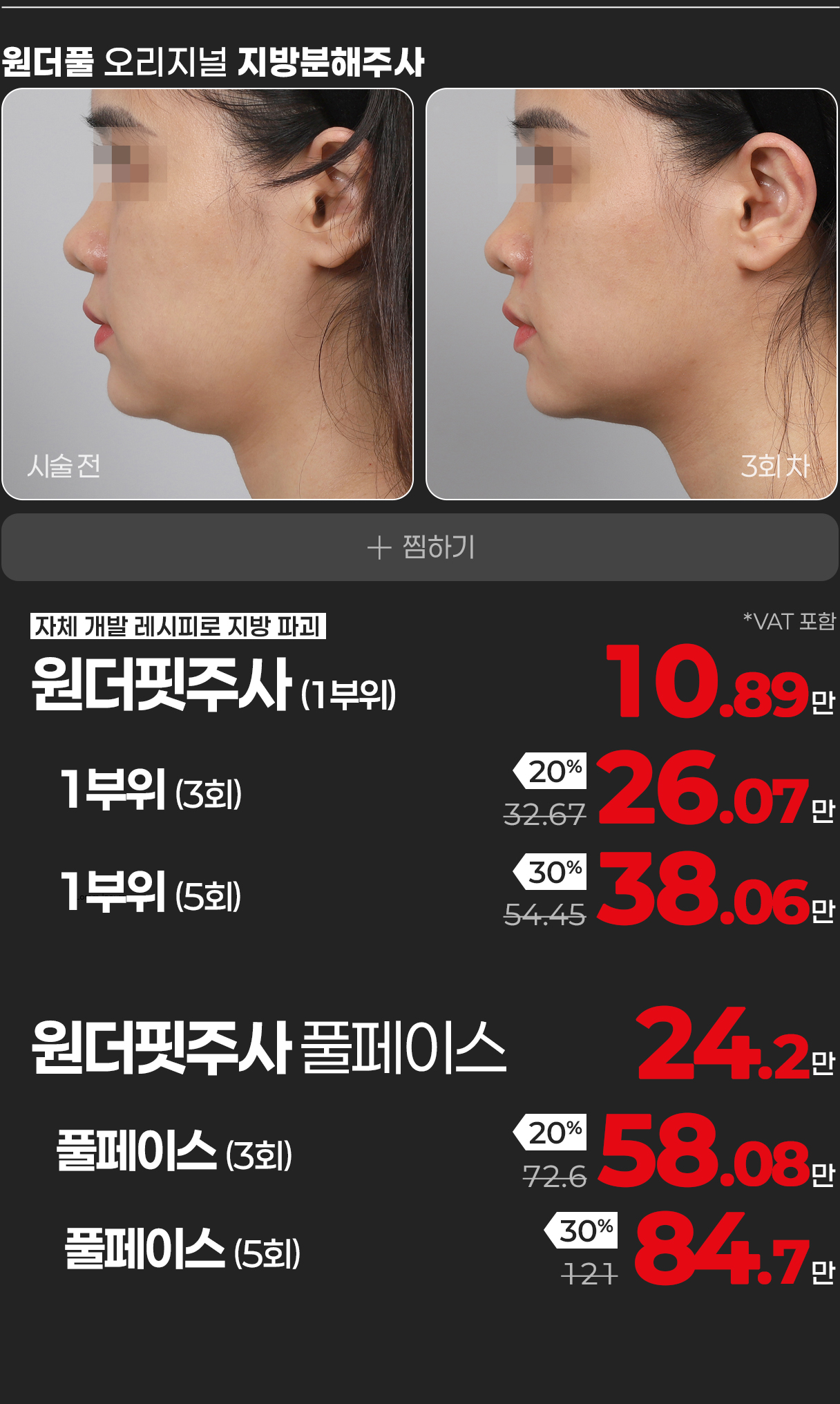 원더핏 주사 안내