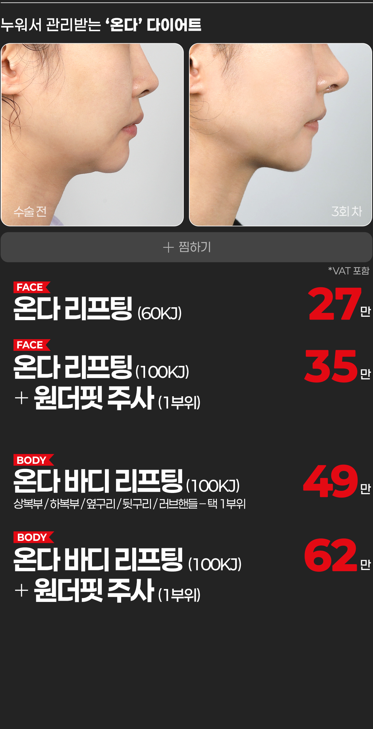 온다 리프팅 안내