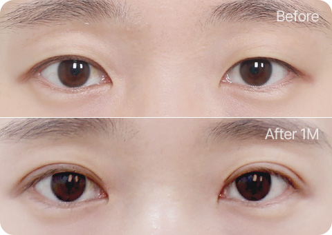 원더풀 자연유착 위트임