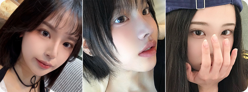 원더풀 라인낮추기 두줄따기 노하우 숙련된 의료진 고난이도 재수술 눈재수술