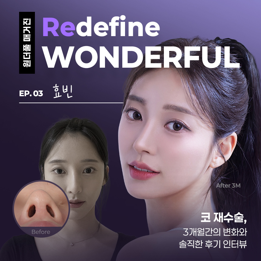 3번째 코재수술