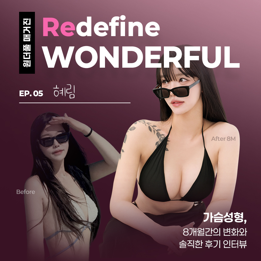 역대급 볼륨, A to G