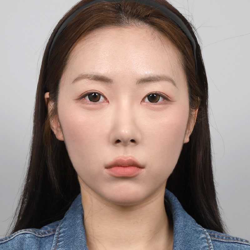 후