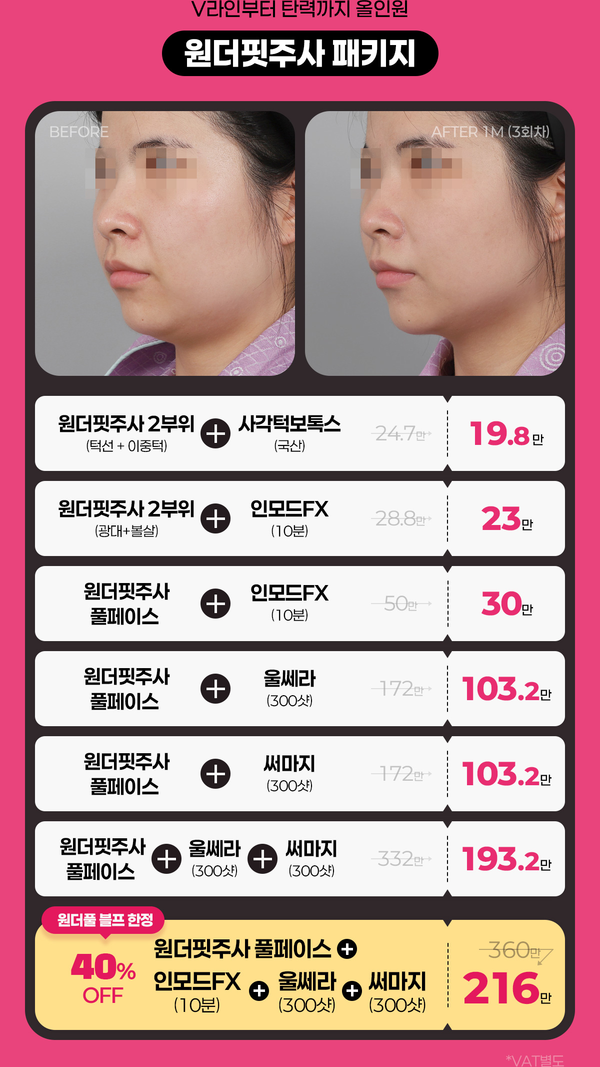 원더핏 주사 패키지 원더핏주사 사각턱보톡스 인모드 울쎄라 써마지