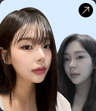 다음 모델 1