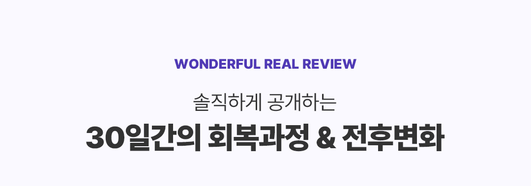 리얼후기 타이틀