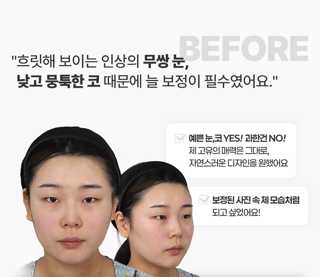 Before 코멘트