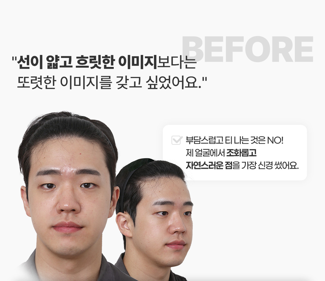 Before 코멘트