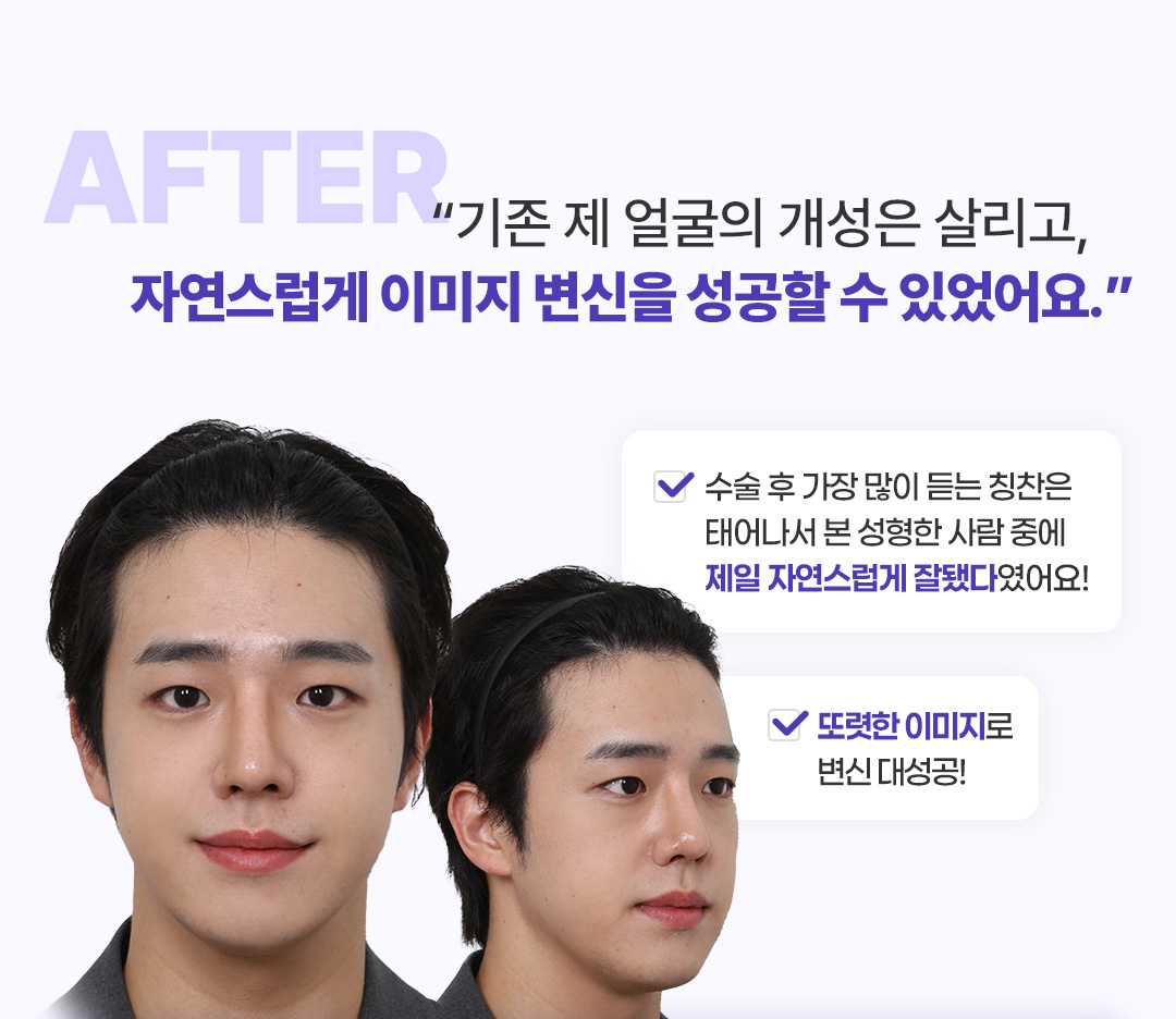 After 코멘트