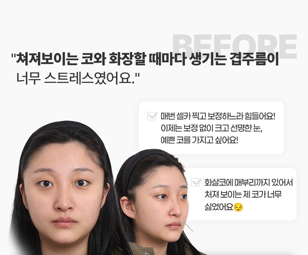 Before 코멘트