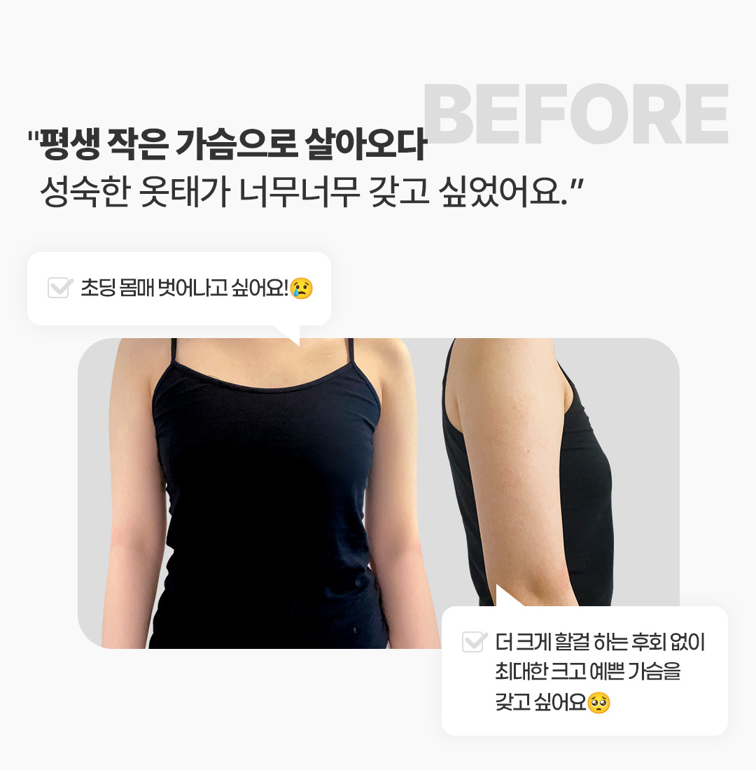 3개월 후 이미지