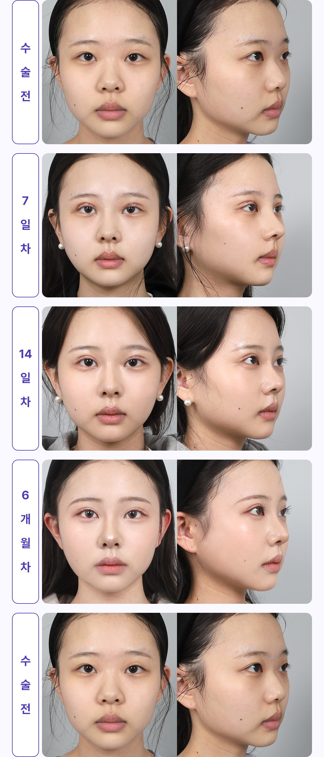 6개월 변화과정