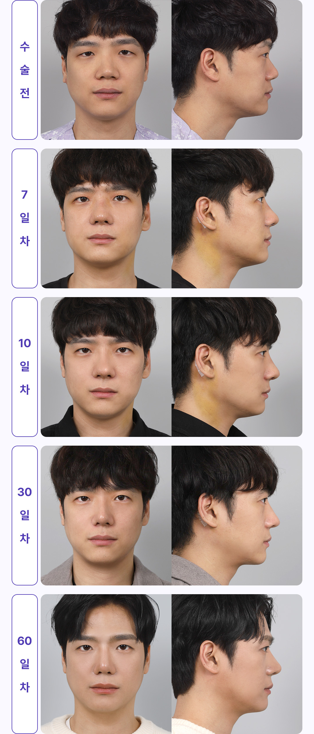 30일간 변화과정