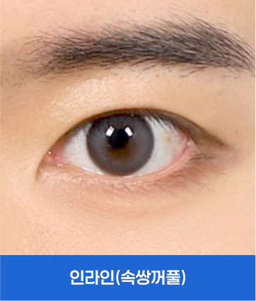 인라인(속쌍꺼풀)