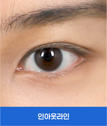 인아웃라인