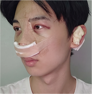 윤하 회복 기록 수술 당일