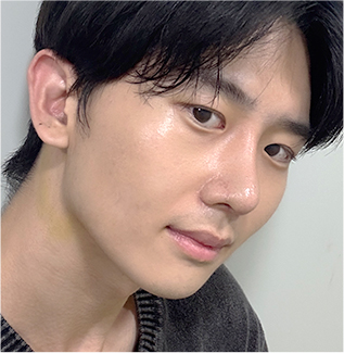 윤하 회복 기록 D+14