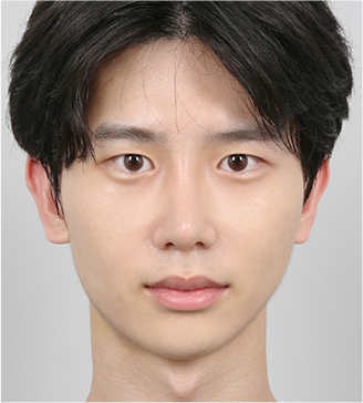 정면 14일 차