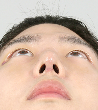 아래 7일 차