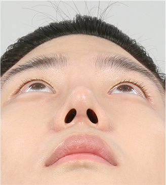 아래 14일 차
