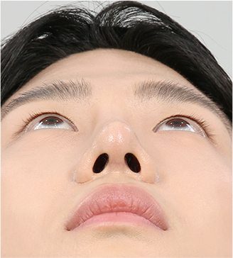 아래 1개월 차