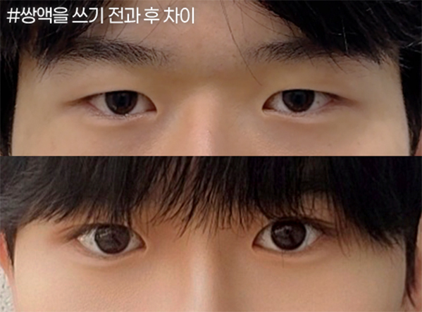 쌍액 사용 전후 눈매
