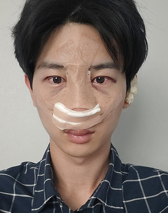 수술 직후 윤하