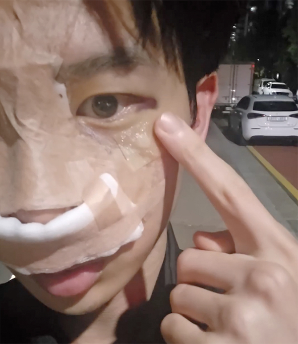 수술 후 눈 상태
