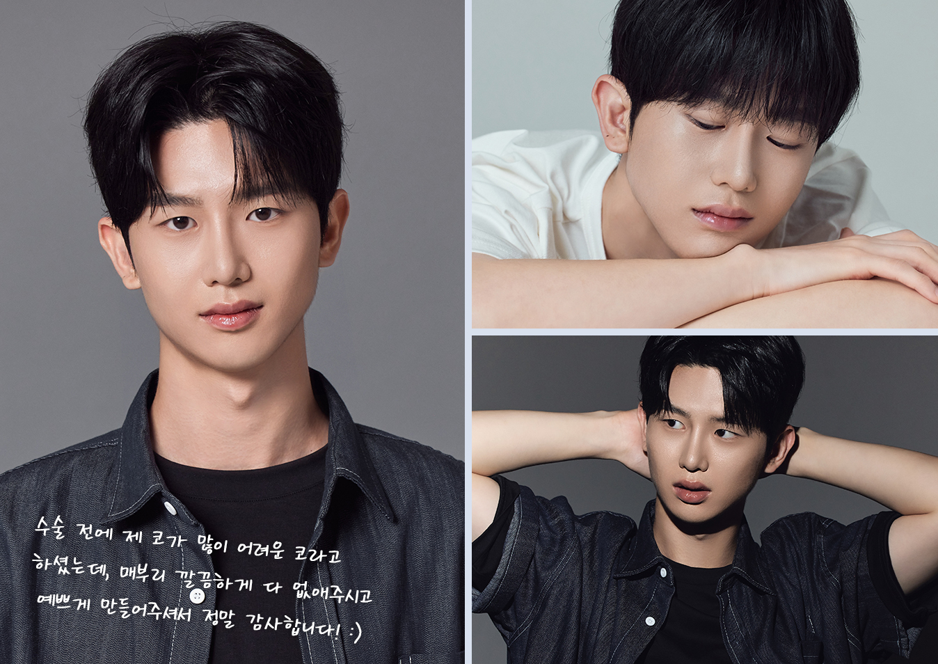 윤하의 새로운 시작. 수술 전에 제 코가 많이 어려운 코라고 하셨는데, 매부리 깔끔하게 다 없애주시고 예쁘게 만들어주셔서 정말 감사합니다!