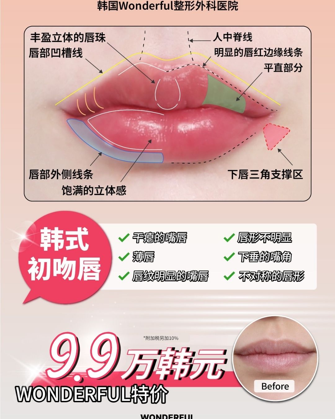 🌹本月特惠🌹